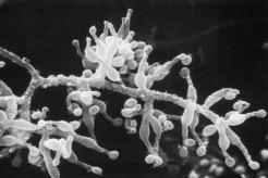 换就有生机!每年30万人在生死边缘排队等候…