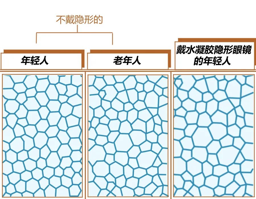 隐形眼镜怎么戴可以减少角膜损害,隐形眼镜戴多长时间不伤角膜