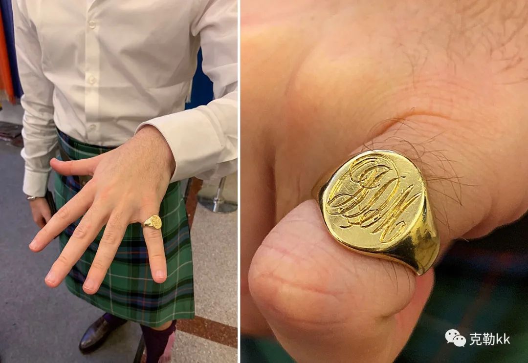 这个戒指，是你身体的一部分