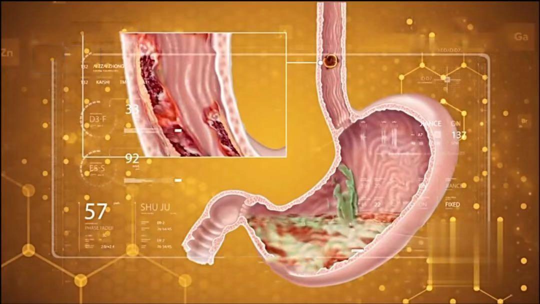 消化不好大家都是怎么治好的,消化不好的5大征兆