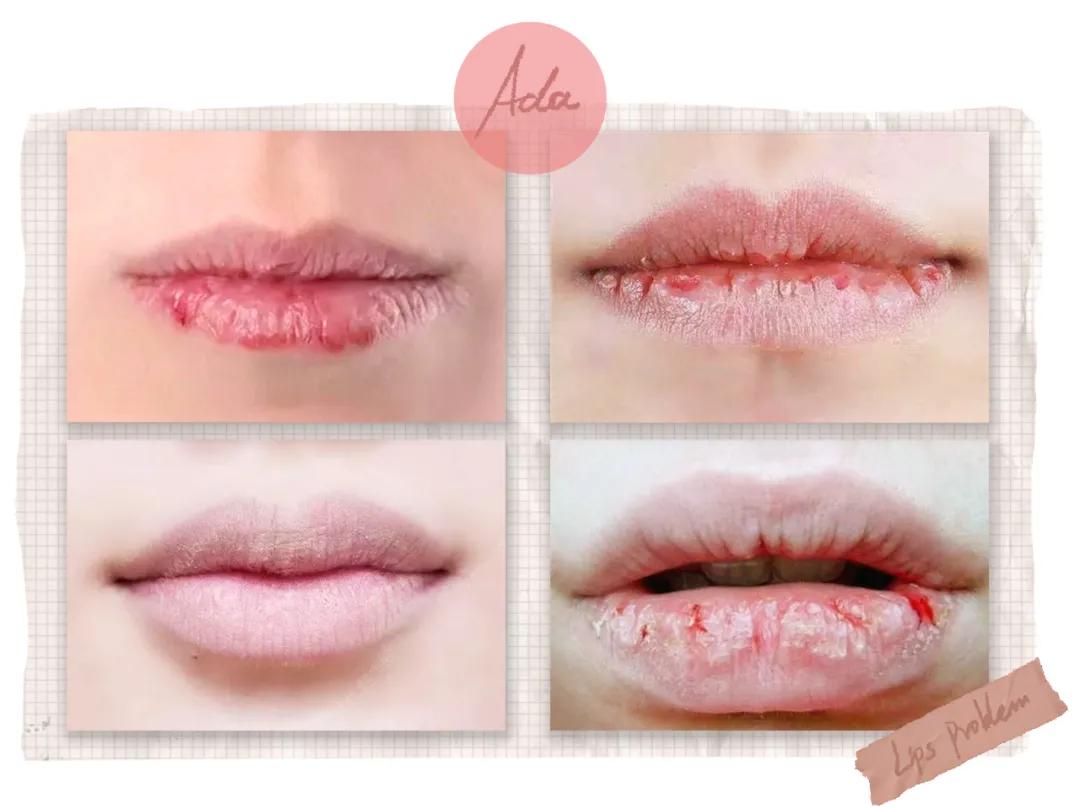 唇膏选不对有致癌风险,唇膏致癌真假