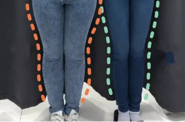 日本4分钟变态减肥法,腿部抽脂大象腿真实案例