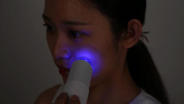 痘痘闭口挤出来的是什么,闭口痘痘挤出来白色物质