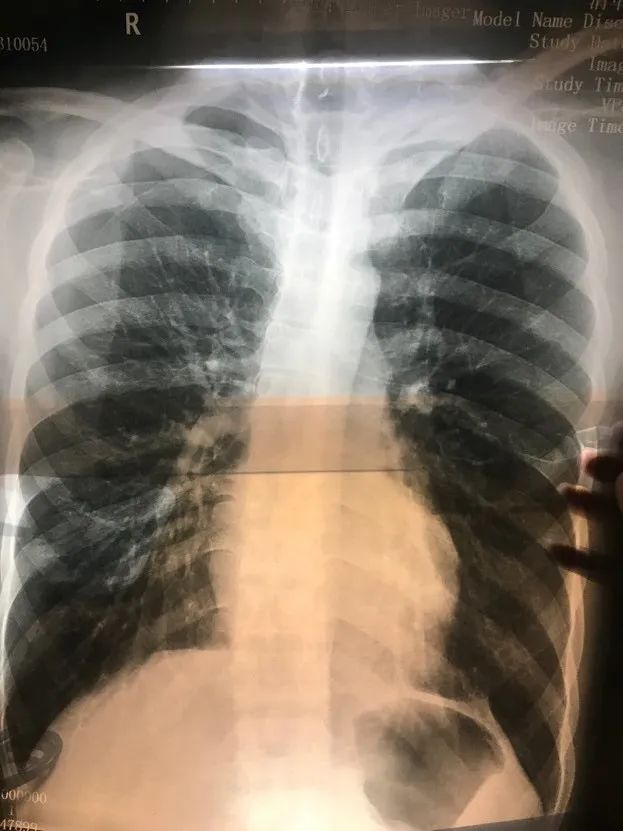 学医面对癌症,在清华学医