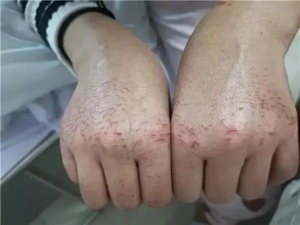 闈掕鐩樼偣,闈掓灚鐩樼偣