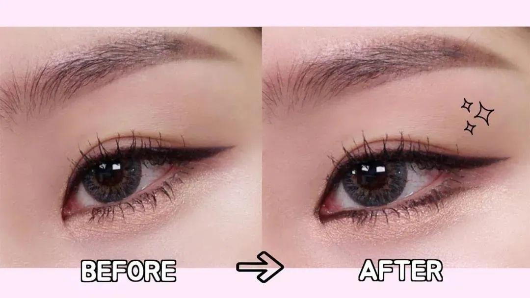 眼综合包含在眼综合吗,眼综合每个人都适合吗