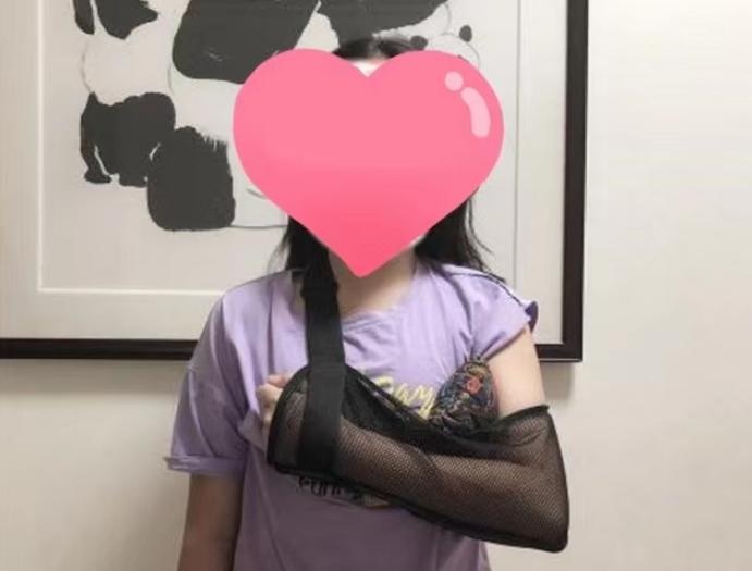 骨折移位手法复位,骨折移位做手术还是石膏固定