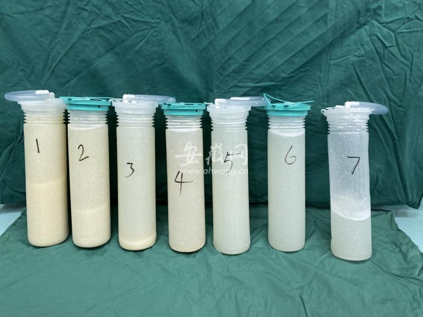 肺里洗出23瓶“牛奶”,肺里吸出牛奶