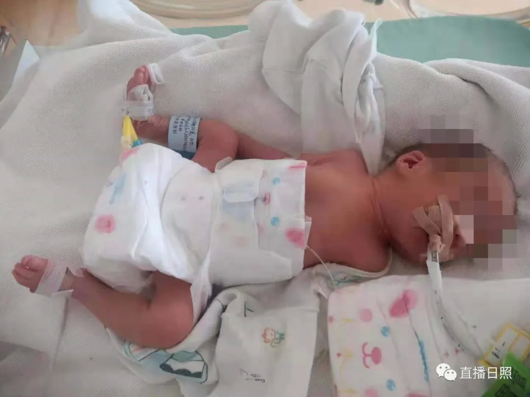 心疼！出生只有3斤重，一起帮帮这个小家伙