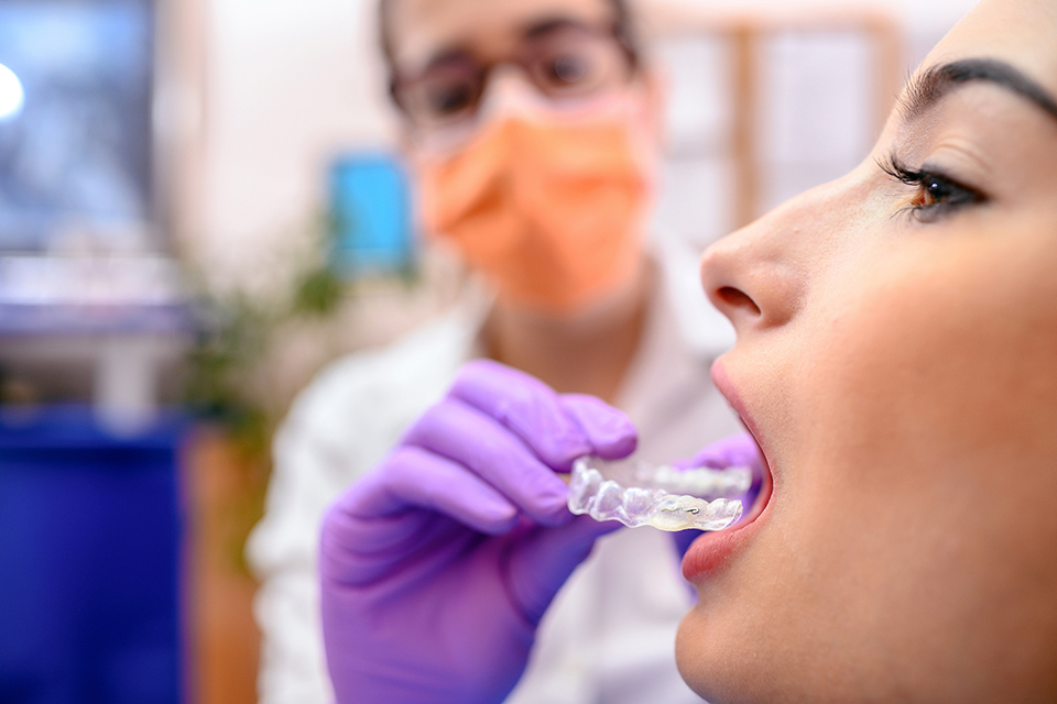 隐形牙套销售市场的潜规则,网购隐形牙套成功案例