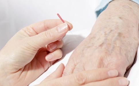 中医针灸治疗痛风效果好吗,针灸痛风怎么下针视频