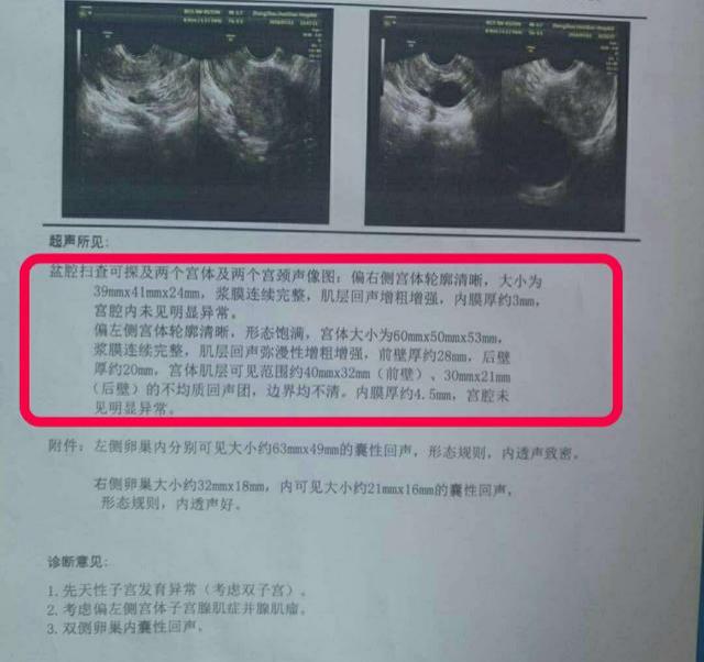 子宫腺肌症合并子宫憩室怎么办,子宫腺肌症腹腔镜子宫全切手术