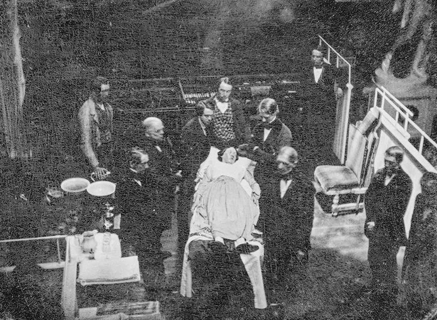 剖宫产过程亲身经历,剖宫产亲身经历