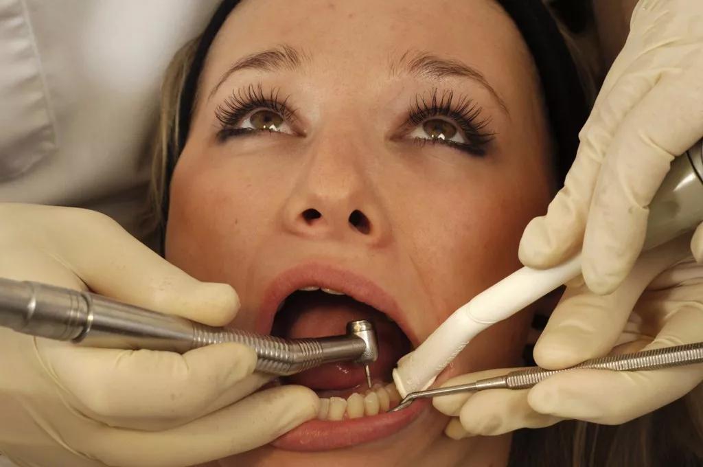 口碑好的补牙齿到底怎么样,补牙材料不对劲