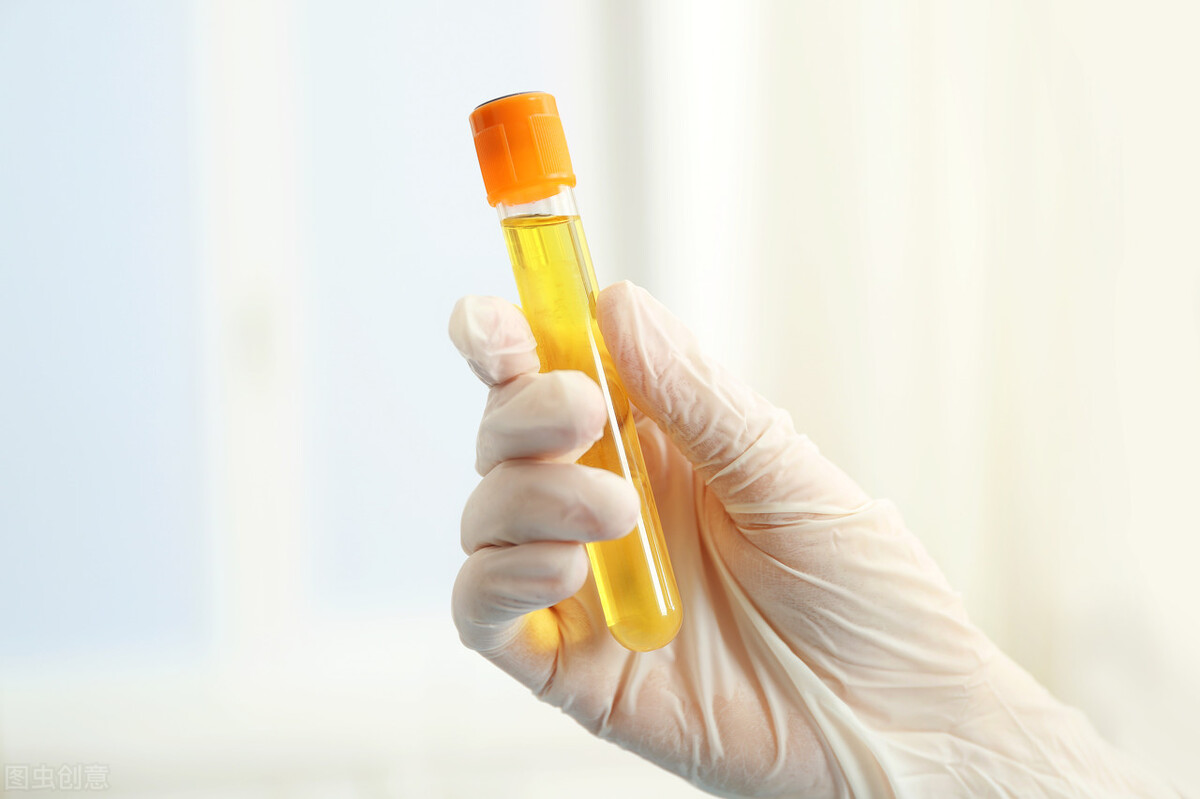 膀胱癌骶骨信号异常,膀胱癌早期有尿频尿急的症状吗