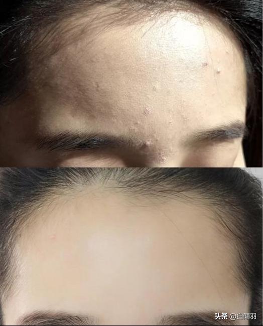 每天这样做皮肤柔嫩光泽,如何省钱买牛年限定皮肤