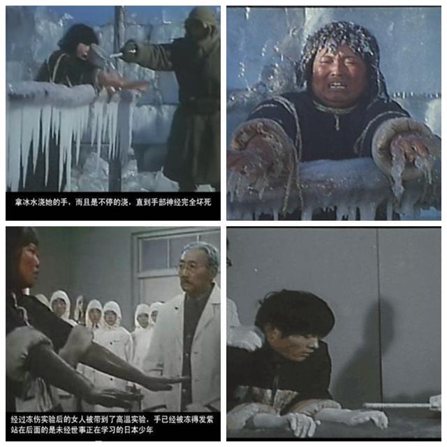 731部队的冻伤实验,731部队冻伤实验是为了什么