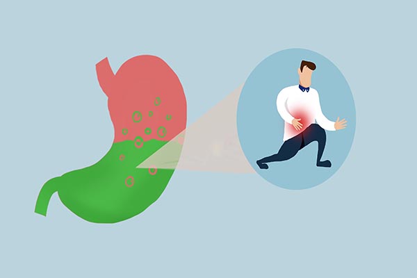 反酸烧心有这四种治疗方法,反酸烧心的原因及治疗方法