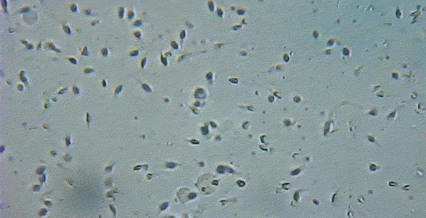 研究显示：精子像钻头一样钻入体内！它“欺骗”了科学家300多年