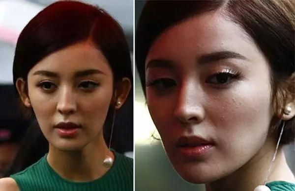 娜扎闭口怎么消除,娜扎刘诗诗原装脸