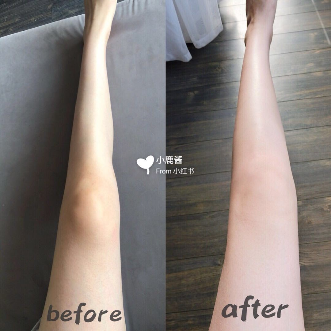 最近很火的变白推荐,公认全身变白的产品