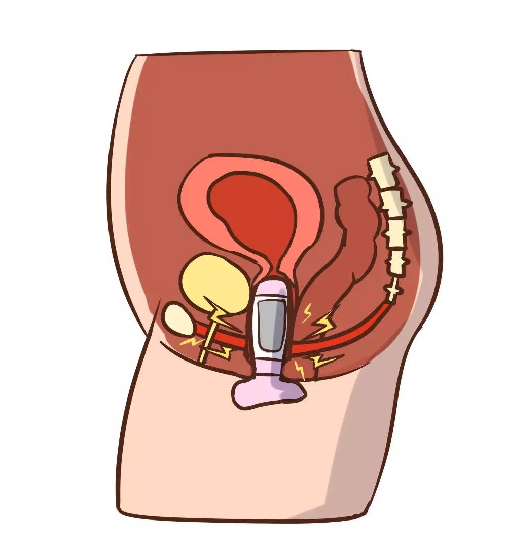 自己如何正确的找到盆底肌,改善盆底肌的正确方法