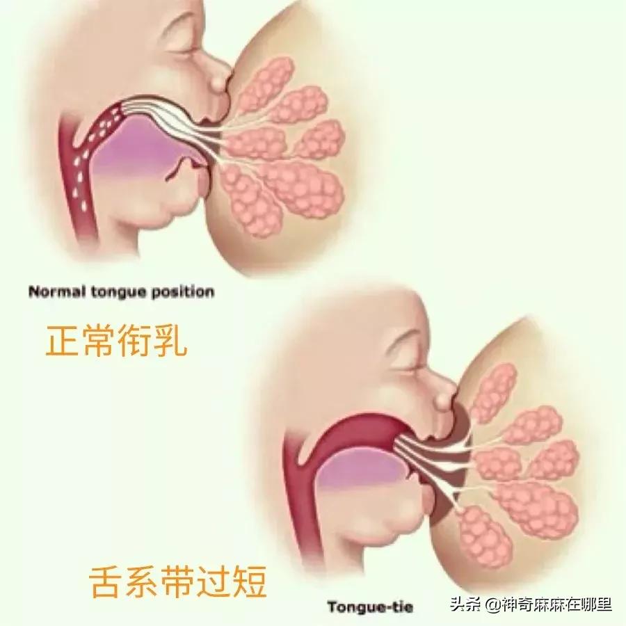 宝宝的舌头有点红怎么回事,宝宝的舌头有红点