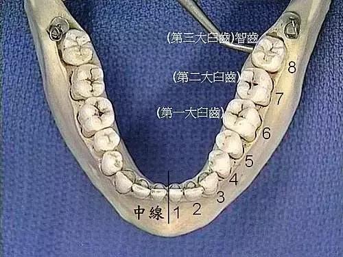 智齿发炎过程中为什么不能拔,智齿有发炎的经历了不拔可以吗