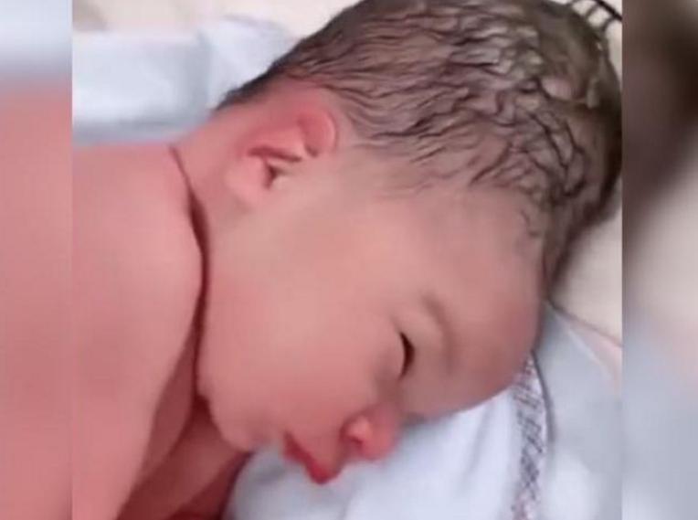 分娩时婴儿头部挤压怎样恢复,分娩时宝宝脑袋被挤压变形