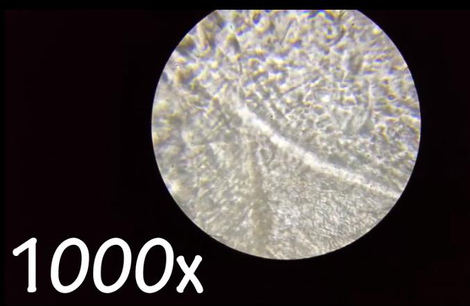 在显微镜下的耳屎有多脏,把耳屎放在显微镜下是什么