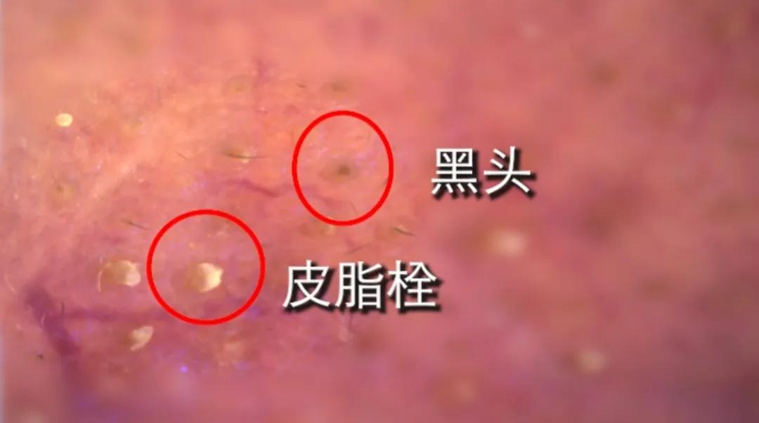 韩国vt老虎泥膜官方,韩国老虎vt泥膜