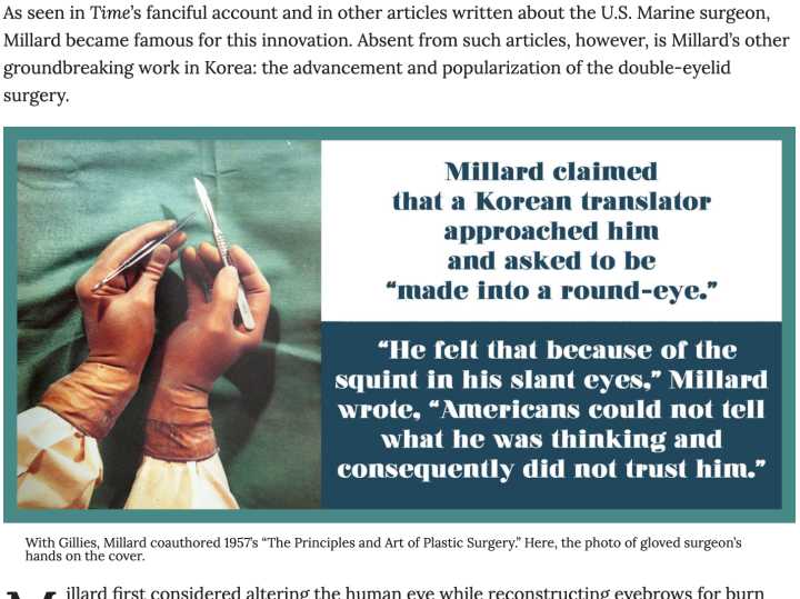 单眼皮肿眼泡割双眼皮多少钱,为什么单眼皮的人喜欢双眼皮