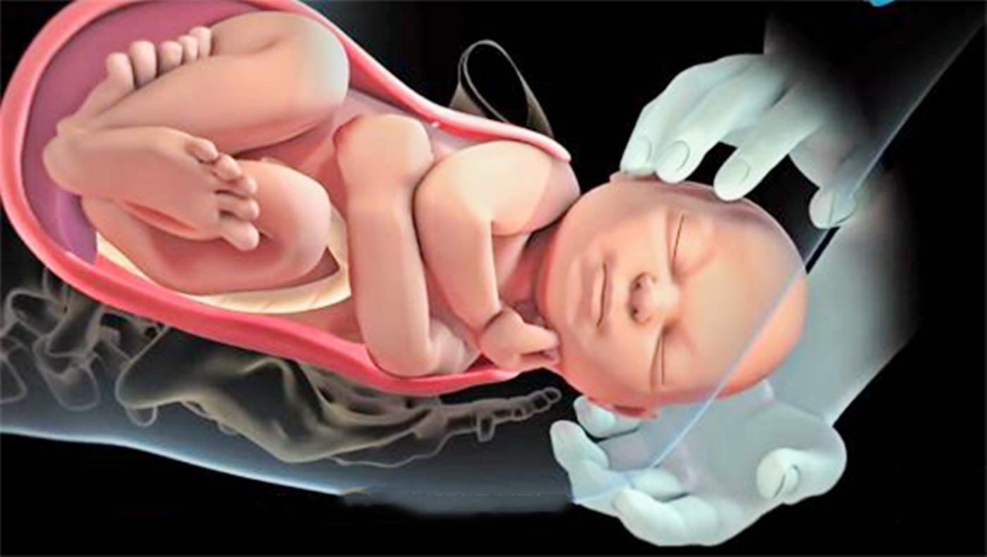 产道那么窄孩子怎么能生得出来呢,胎儿是怎么从狭小的产道出生的