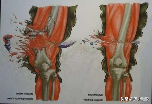 中弹后会迅速丧失行动能力吗,中弹后会立马倒下吗