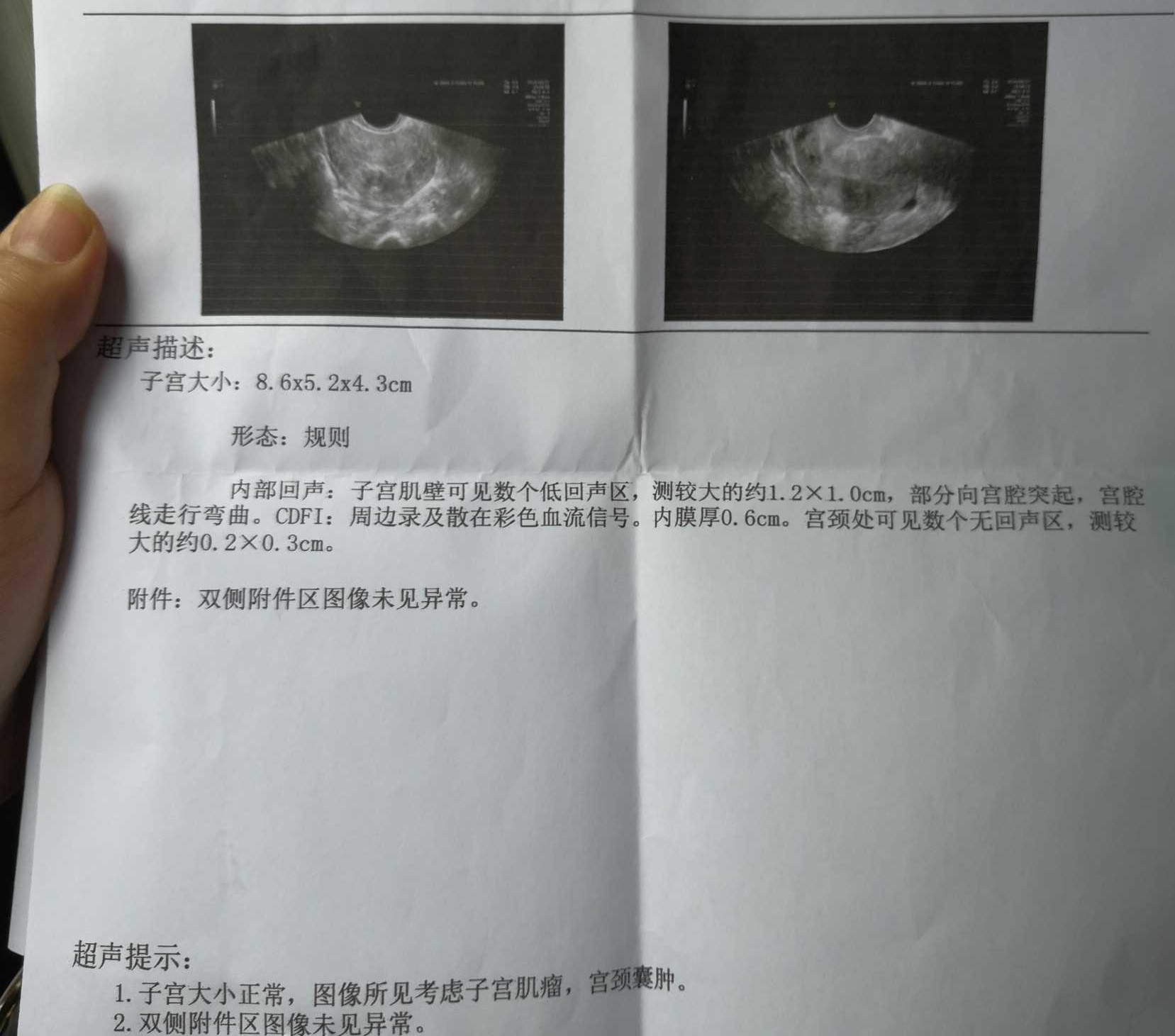 我48岁有子宫肌瘤停经半年又来了,我57岁子宫肌瘤6厘米需要怎么治疗