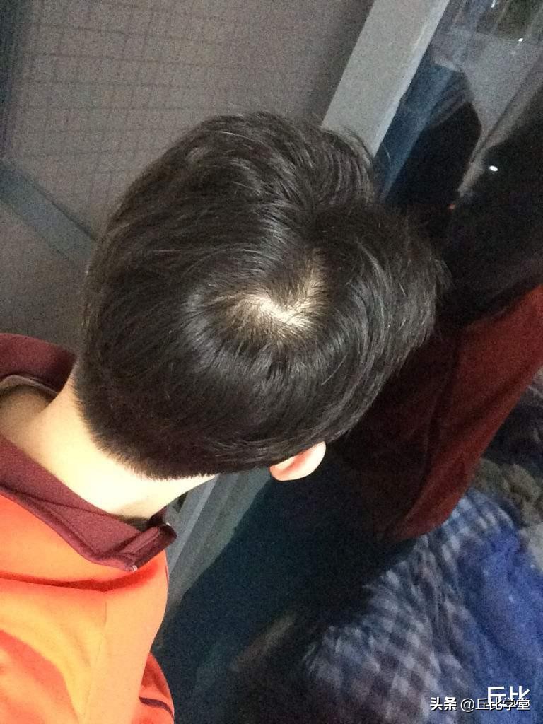 人头发后面都有个旋吗,人头上有几个旋