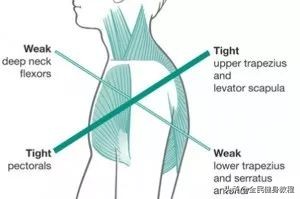 胸小肌问题,胸小肌是深层肌肉吗