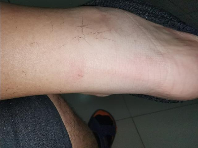 罗斯玫瑰战靴,玫瑰十年