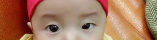宝宝双眼不一样大,宝宝眼睛大小不一样什么原因