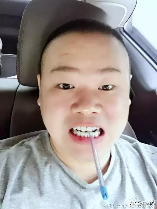 全隐形牙套矫正牙齿大概多少钱,隐形牙套咋改善脸型