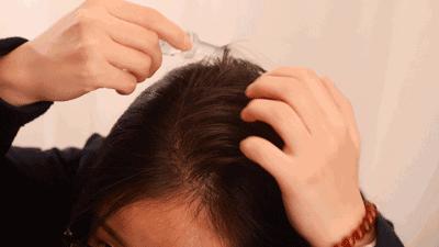 生娃是罐秃顶剂,从此我变成了裘千尺