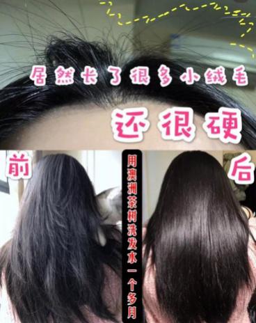 头发蓬松茶树油洗发水,油头救星澳洲茶树洗发水