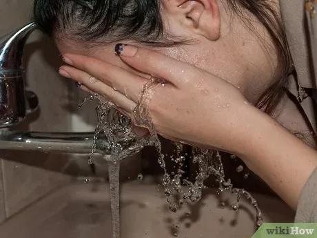 如何去除粉刺闭口,如何去除粉刺最快最有效