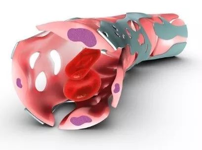 老年人腿疼怎么判断是骨质疏松,老年人腿脚无力是什么病