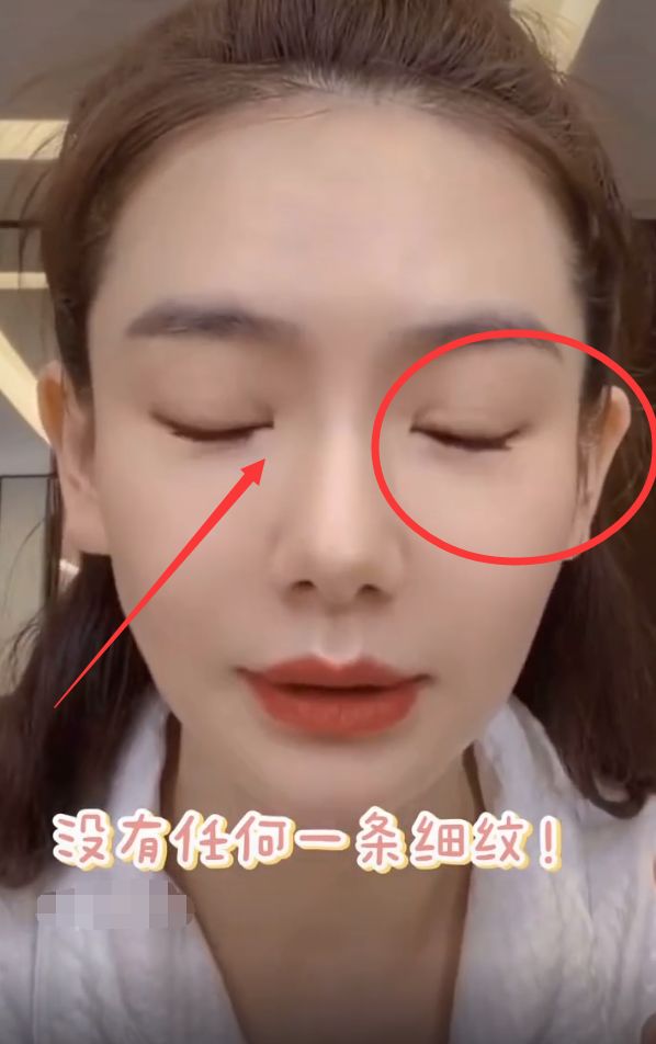 戚薇眼睛双眼皮前后,戚薇双眼皮前后对比照真实