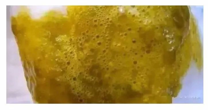 怎样判断新生儿宝宝大便是否正确,新生儿宝宝大便怎么判断是否正常