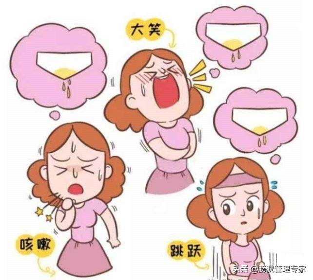 产后会尿失禁吗,产后尿失禁普遍吗