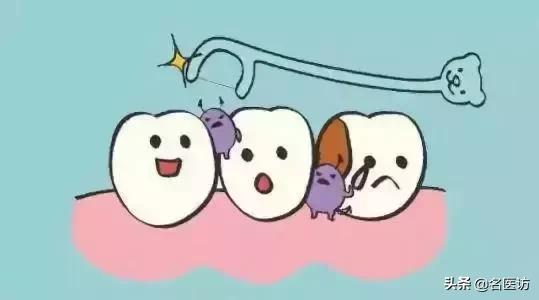 牙周炎才是牙齿松动的罪魁祸首,牙周炎导致全部牙齿脱落镶什么牙