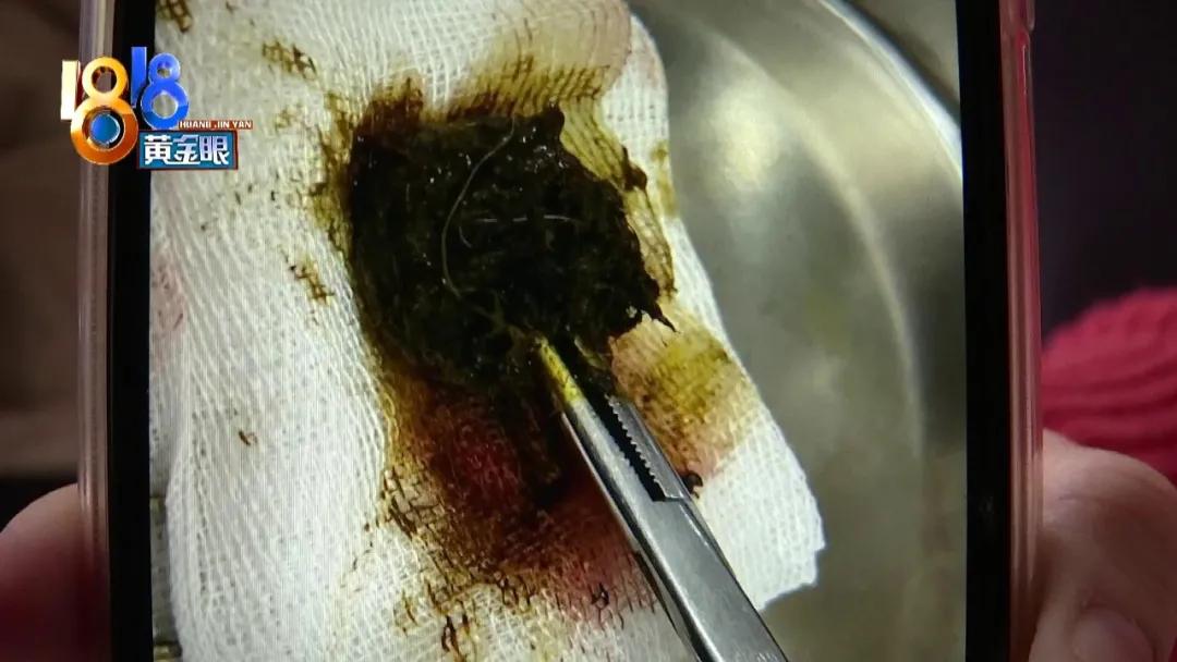 柯基犬突然呕吐是什么原因,柯基犬呕吐拉血是什么原因