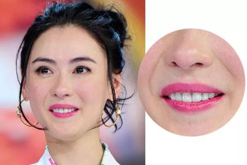 怎么能淡化法令纹的小妙招,法令纹显老不用愁一招改善法令纹